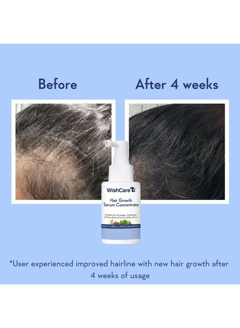 WishCare Hair Growth Serum Concentrate | Redensyl, Anagain, Baicapil, Rosemary, Caffeine, Biotin & Rice Water | Advanced Serum for Scalp | Controls Hairfall & Boosts New Growth | In-Vivo Tested | For Men & Women 30ml - Image 5